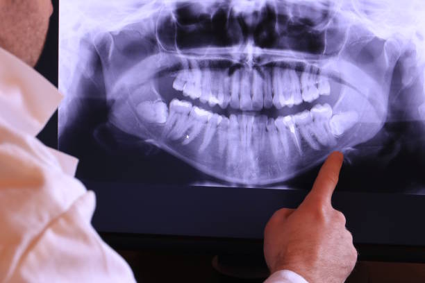 Best Emergency Dental Extractions in Loudonville, NY