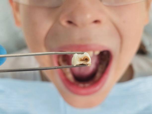 Best Emergency Dentist for Knocked-Out Tooth in Loudonville, NY